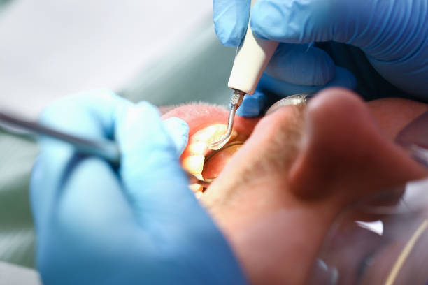 Best Mobile Emergency Dentist in Tiger Point, FL