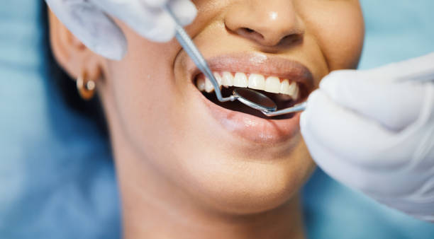 Best Emergency Dental Care for Abscessed Tooth in Tiger Point, FL